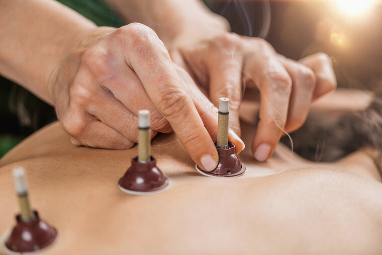 Moxibustion Therapie